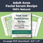Adult Acne Face Serum Recipe PDF (100% Natural)
